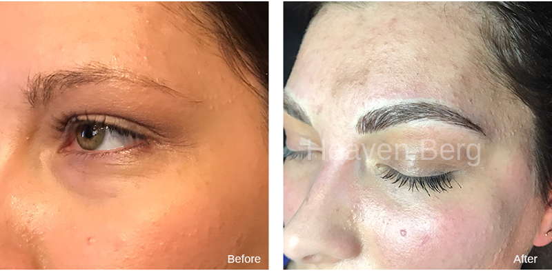 Microblading Before And After